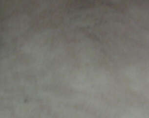 人ãҽƷ
